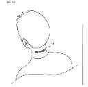 Fig. 05 - BAND FOR PREVENTING WRINKLES