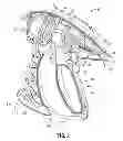 Fig. 04 - Surgical forceps