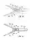Fig. 10 - Overmolded grasper jaw