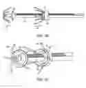 Fig. 08 - System and method for transapical access and closure