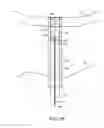 Fig. 12 - System and method for transapical access and closure