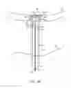 Fig. 14 - System and method for transapical access and closure
