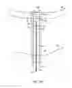 Fig. 15 - System and method for transapical access and closure