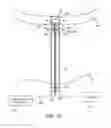 Fig. 35 - System and method for transapical access and closure