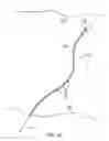 Fig. 46 - System and method for transapical access and closure