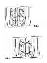 Fig. 03 - Method of closure for thoracotomy and thorascopy incisions