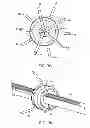 Fig. 09 - System and method for transapical access and closure