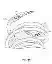 Fig. 40 - System and method for transapical access and closure