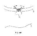 Fig. 43 - System and method for transapical access and closure