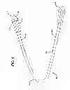 Fig. 02 - Directionally specific bone anchors and method