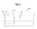 Fig. 04 - Directionally specific bone anchors and method