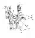 Fig. 02 - SYSTEM AND METHOD FOR ALIGNING VERTEBRAE IN THE AMELIORATION OF ABERRANT SPINAL COLUMN DEVIATION CONDITIONS