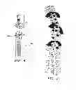 Fig. 04 - SYSTEM AND METHOD FOR ALIGNING VERTEBRAE IN THE AMELIORATION OF ABERRANT SPINAL COLUMN DEVIATION CONDITIONS