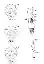 Fig. 07 - Percutaneous vertebral stabilization system