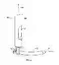 Fig. 08 - Percutaneous vertebral stabilization system