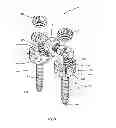 Fig. 09 - System and method for dynamic vertebral stabilization