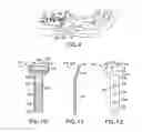 Fig. 04 - Method of using a volar bone plate on a fracture