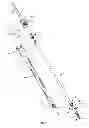 Fig. 02 - Surgical instrument and method