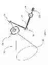Fig. 06 - Laser Projected Display for Implant Orientation and Placement