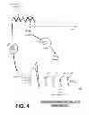 Fig. 04 - External defibrillation with automatic post-shock anti-tachycardia (APSAT) pacing