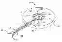Fig. 01 - METHOD AND APPARATUS FOR ARRHYTHMIA DETECTION IN A MEDICAL DEVICE