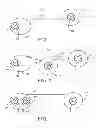 Fig. 02 - METHOD AND APPARATUS FOR ARRHYTHMIA DETECTION IN A MEDICAL DEVICE
