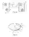 Fig. 03 - METHOD AND APPARATUS FOR ARRHYTHMIA DETECTION IN A MEDICAL DEVICE