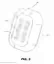 Fig. 06 - IMPLANTABLE STIMULATOR