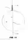 Fig. 12 - IMPLANTABLE STIMULATOR