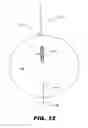 Fig. 13 - IMPLANTABLE STIMULATOR