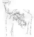 Fig. 01 - Pacemaker event queue to control device processor operating power