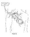 Fig. 02 - Pacemaker event queue to control device processor operating power