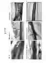 Fig. 23 - Nerve electrode provided with anti-inflammatory drug and method of manufacturing the same