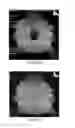 Fig. 15 - Implantable medical device