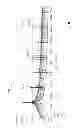 Fig. 09 - Modulator apparatus configured for implantation