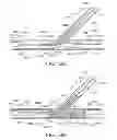 Fig. 35 - System and methods for treating a bifurcation with a fully crimped stent