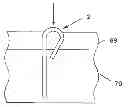 Fig. 01 - ATTACHMENT DEVICE AND METHODS OF USING THE SAME