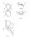 Fig. 04 - ATTACHMENT DEVICE AND METHODS OF USING THE SAME