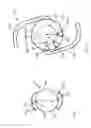 Fig. 03 - Remote multifocal to monofocal optic conversion