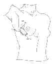 Fig. 01 - Surgical template and delivery device