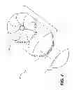 Fig. 05 - Surgical template and delivery device