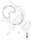 Fig. 07 - Surgical template and delivery device