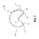 Fig. 08 - Surgical template and delivery device