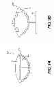 Fig. 10 - Surgical template and delivery device