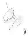 Fig. 12 - Surgical template and delivery device