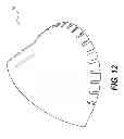 Fig. 13 - Surgical template and delivery device