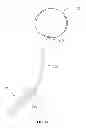 Fig. 02 - RESTORATIVE POST-LUMPECTOMY IMPLANT DEVICE