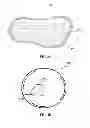 Fig. 05 - RESTORATIVE POST-LUMPECTOMY IMPLANT DEVICE