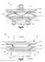 Fig. 04 - Articulating intervertebral implant