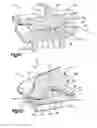 Fig. 33 - Articulating intervertebral implant